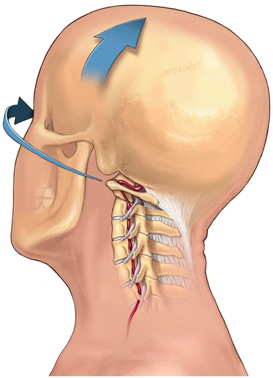 Going to a Chiropractor is Riskier Than You Think